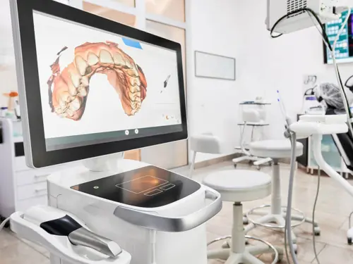 CEREC dental scanner and milling machine in Tucson, Arizona