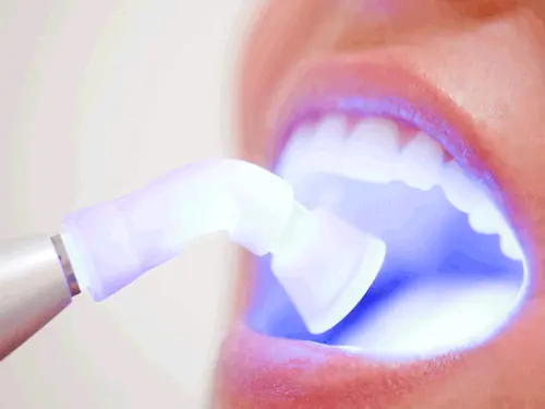 Soft-Tissue Dental Laser in Tucson, AZ at Tucson Dental Studio